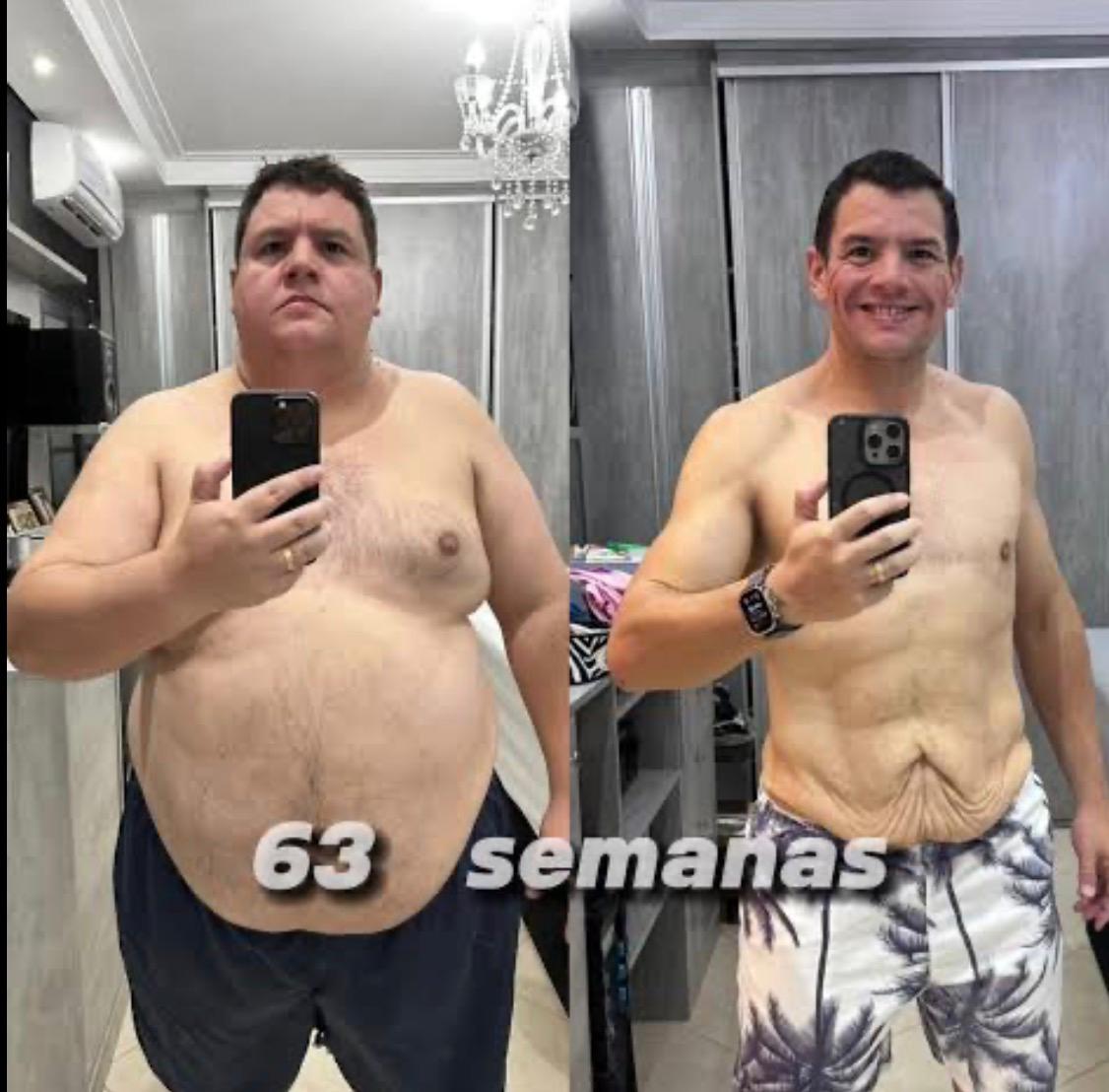 Transformação real de Roberto S., 47 anos — -42 kg em 63 semanas com Mounjaro Natural
