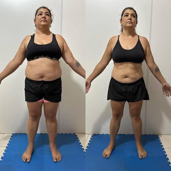 Transformação real de Camila R., 38 anos — -11 kg em 16 semanas com Mounjaro Natural
